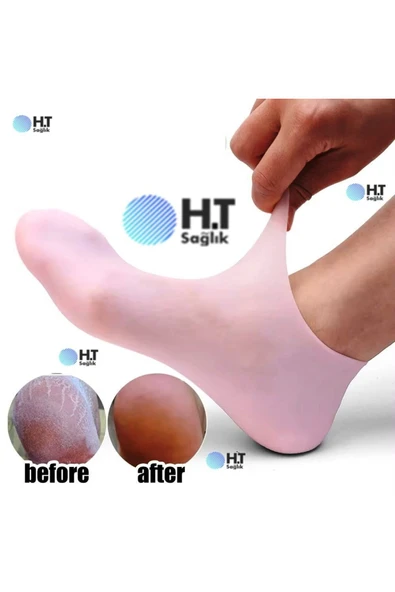 Silikon Jel Nemlendirici Ayak Bakım Çorabı - topuk çatlağı nasır
