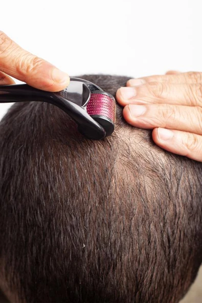 Aveo 1mm 540 iğneli Titanyum Uçlu Saç Sakal Çıkarma Tarağı İğneli Cilt Yenileyici Gözenek Açıcı İğneli Dermaroller 1mm - Resim 4