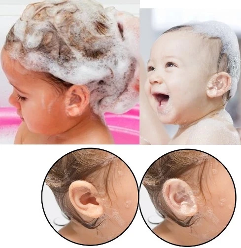 Bebek Banyo Kulak Koruyucu Bant 10 Adet - 2