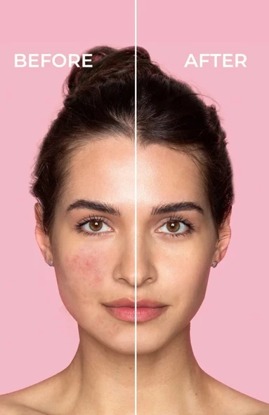 Sinoz Pure Cica Tiger Grass Yüz Kremi 15 ML - Resim 5