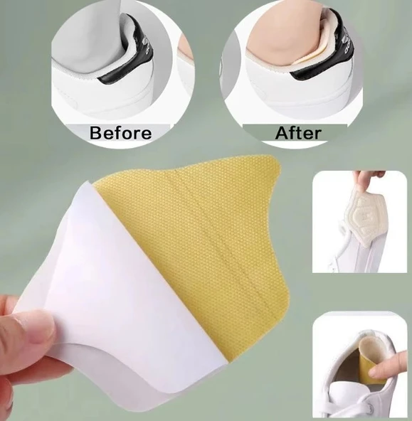 Taç Şeklinde Topuk Vurma Önleyici 10 mm. - 3