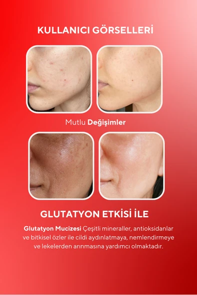 VitaCeel Cilt Aydınlatıcı, Nemlendirici Leke Karşıtı Vegan Gummy Vitamin C, Hyaluronic Acid, Glutatyon, Q10 - 5