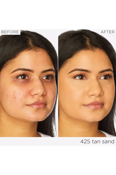 Tarte Shape Tape™ Radiant Concealer - Kapatıcı 16N Fair Light Neutral (10 ml) - 5