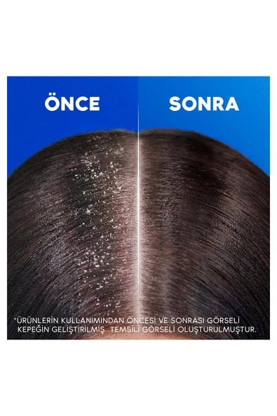 Head & Shoulders Mentol Ferahlığı 2'si 1 Arada Şampuan 300 ml - Resim 7