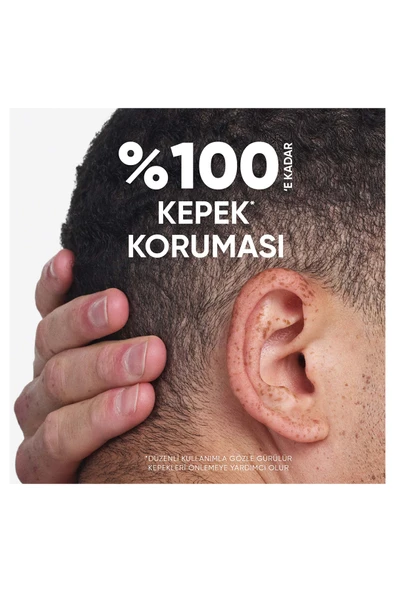 Head & Shoulders Mentol Ferahlığı 2'si 1 Arada Şampuan 300 ml - Resim 5