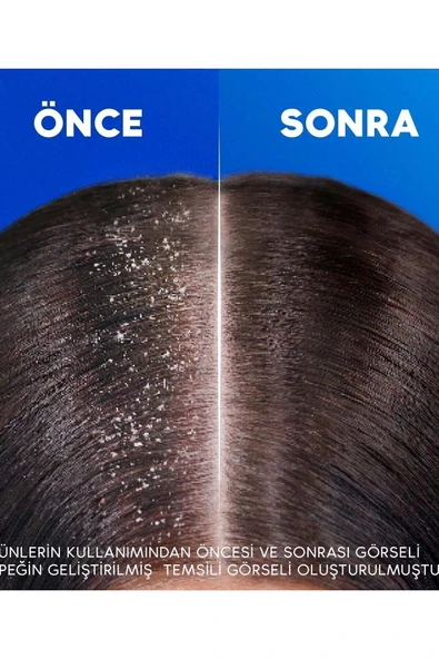 Head & Shoulders Derinlemesine Nemlendirici Hindistan Cevizi Yağı Şampuan 330 ml - 5