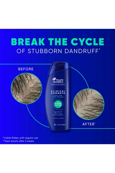 Head & Shoulders Clinical Strength Cooling Itch Relief Kepek Karşıtı Şampuan 400ML - Resim 6