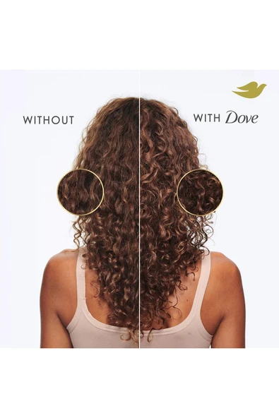 Dove Damage Kuruluk Karşıtı Kepek Şampuanı 355ML - 4