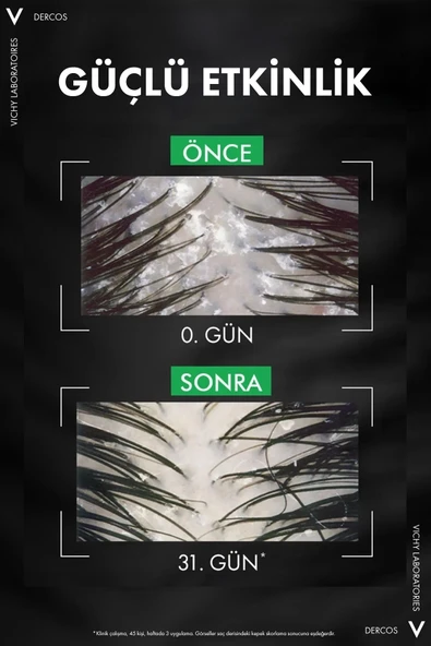 Vichy Dercos Anti Dandruff Kuru Saçlar İçin Kepek Karşıtı Şampuan Refill 390 ml - Resim 4