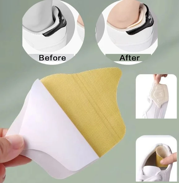 Taç Şekilli 10 mm Topuk Daraltma ve Vurma Önleyici - 5