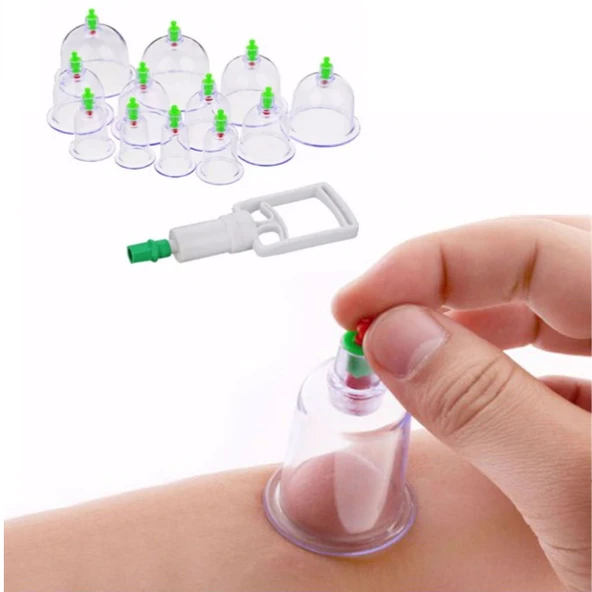 Hacamat Kupası 12’li Çekme Seti Vakumlu Masaj Aleti (5250)