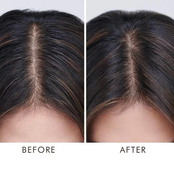 Moroccanoil Oily Scalp Treatment 45 Ml - 4