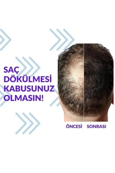 Pak Darou Minioxidil Minoxidil %5 Minoksil Pak Darou ürün görseli