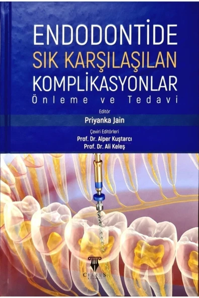 Celsus Kitabevi Endodontide Sık Karşılaşılan Komplikasyonlar Önleme Ve Tedavi