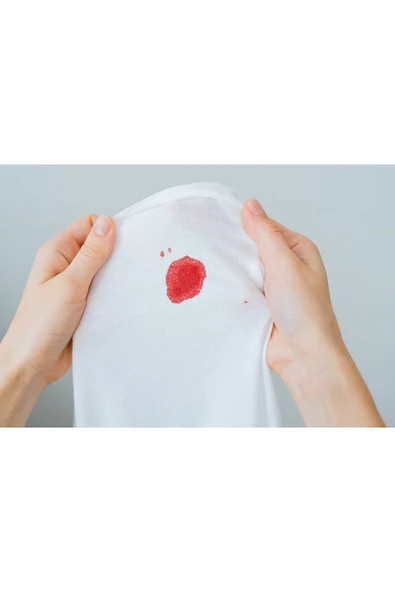 DOSE Çok Amaçlı Leke Çıkarıcı Sprey 400 ml - Resim 4