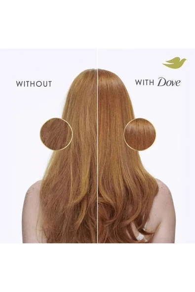 Dove Damage Therapy Yoğun Onarıcı Şampuan 828ML - 4