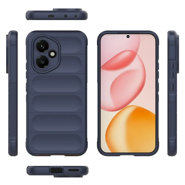 Mobixa Honor 400 Kılıf Aira Premium Esnek TPU Silikon Kapak - Resim 4