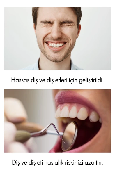 Whirtz Su Püskürtmeli Ağız Duşu – 300ml, Şarjlı, Taşınabilir - Resim 6