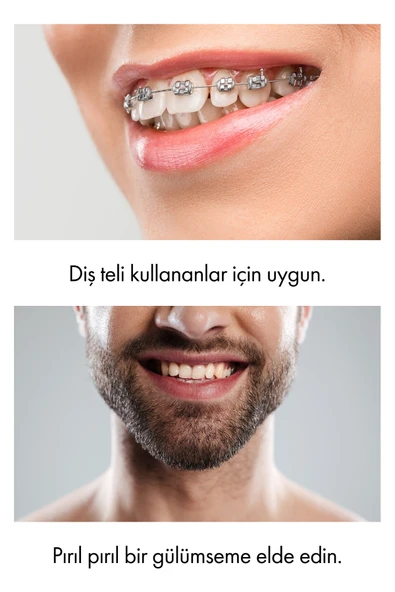 Whirtz Su Püskürtmeli Ağız Duşu – 300ml, Şarjlı, Taşınabilir - Resim 4