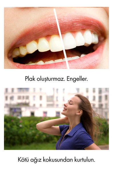 Whirtz Su Püskürtmeli Ağız Duşu – 300ml, Şarjlı, Taşınabilir - Resim 5