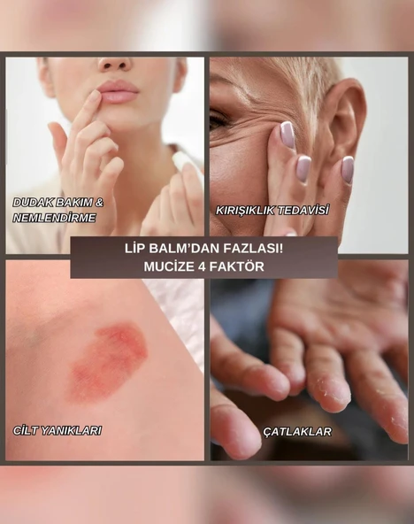 Elvons Lip Balm - Dudak Kremi - Vazelin, Kakao & Shea Yağı - Onarıcı & Nemlendirici Krem 25ml - 3