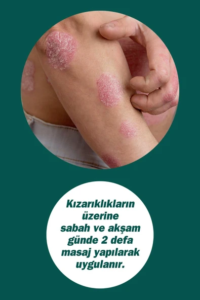 Dermodıcos Krem 30 ml (ÇAY AĞACI YAĞI / TEA TREE OIL) - 4