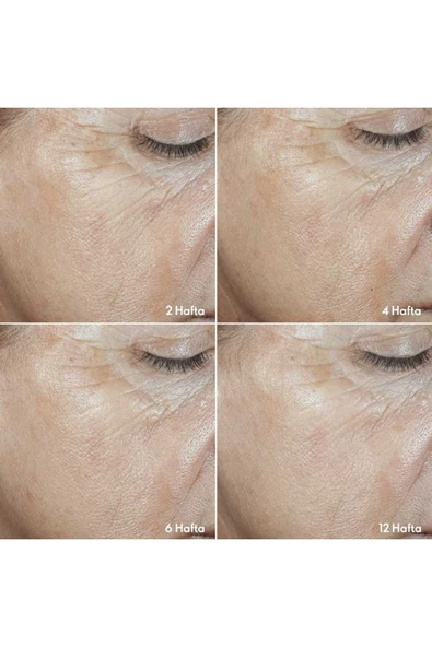 Oriflame Novage+ Kırışıklıkları ve İnce Çizgileri Önemli Ölçüde Azaltan Wrinkle Smooth Cilt Bakım Seti - 7