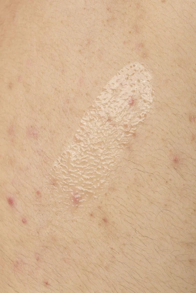 The Ordinary Salicylic Acid 0.5% Vücut Serumu 240ML SKT:01/2026 - 3