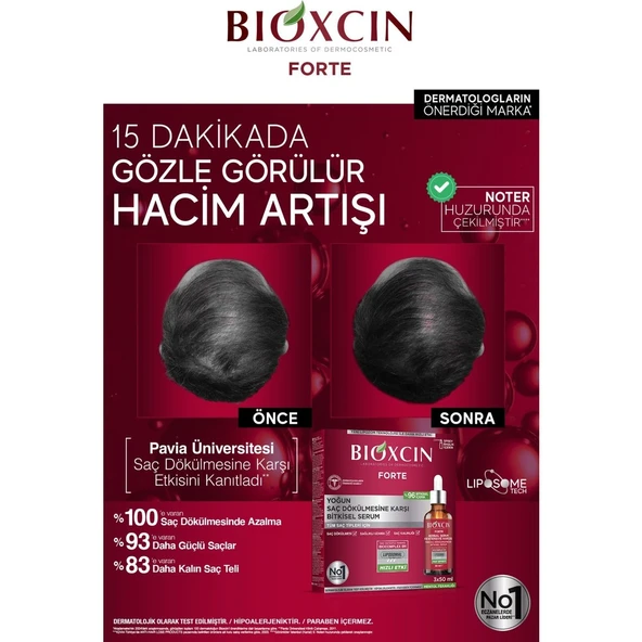 Bioxcin Forte Erkekler için Saç Dökülmesine Karşı Bitkisel Saç Serumu - Lipozom Teknolojisi, 3 x 50 ml - Resim 8