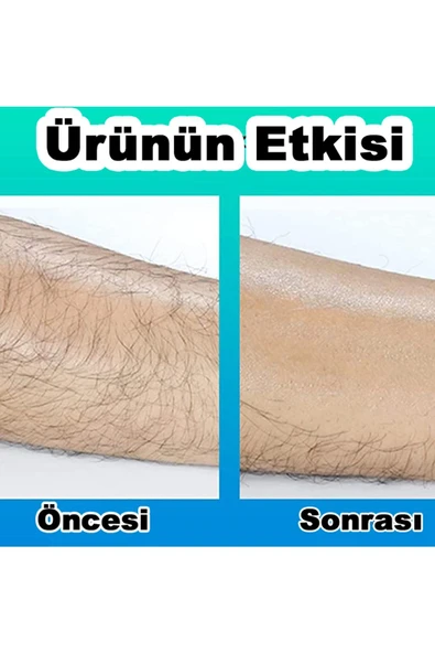 ONULISS Kristal Epilatör Crystal Eraser Epilasyon Tüy Dökücü Sertifikalı - Resim 2