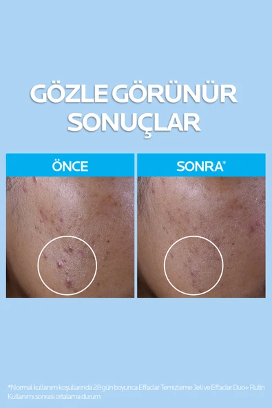 La Roche Posay Effaclar Yağlı ve Akneye Eğilimli Citler için Temizleme Jeli 400 ml - Resim 2