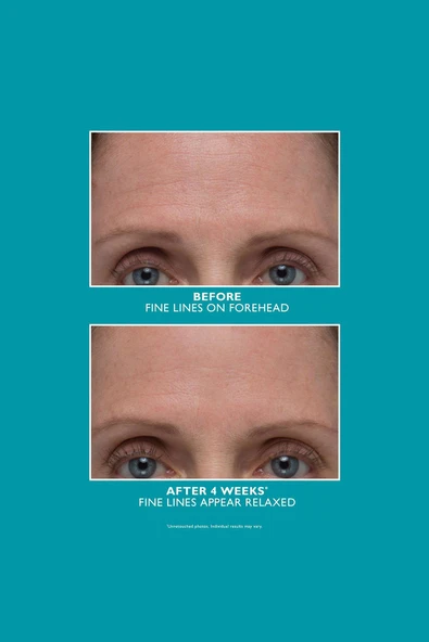 Peter Thomas Roth Peptide Skinjection Amplified Wrinkle-Fix Yüz Serumu 30ML - Resim 6