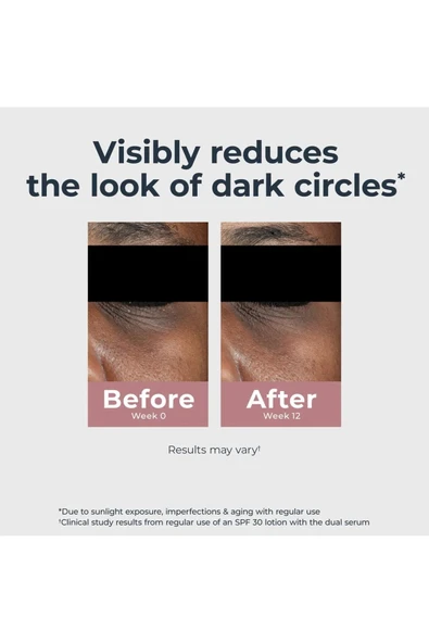 Eucerin Radiant Tone Koyu Leke Karşıtı Göz Kremi 14GR - Resim 7