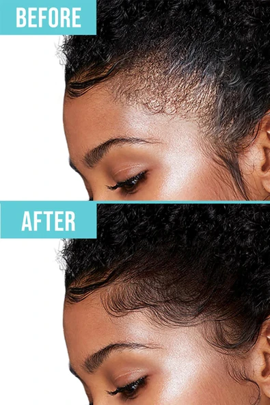 Red by Kiss Saç Kenarı Sabitleme Jeli Karpuz Kokulu 30ML - Resim 8