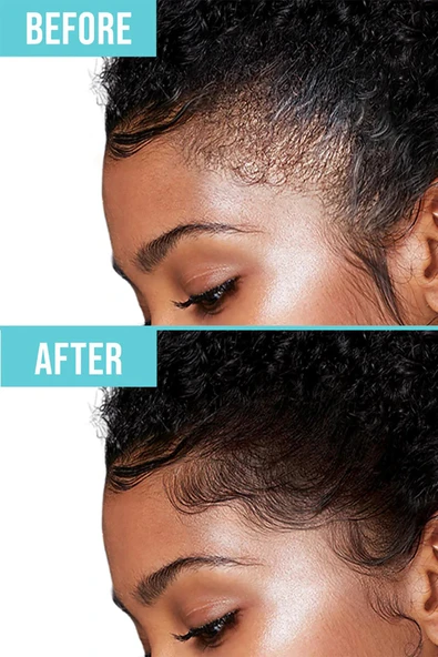 Red by Kiss Saç Kenarı Sabitleme Jeli Kiraz Kokulu 30ML - Resim 7