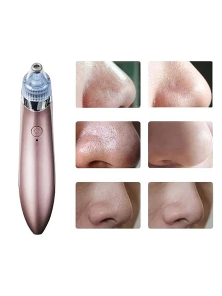 LitaeTrend SİYAH NOKTA CİHAZI ürün görseli