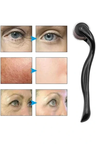 LitaeTrend Dermaroller Titanyum 540 Iğneli 1 Mm Saç Kaş Sakal Serum Kullanıma Uygun - Resim 3