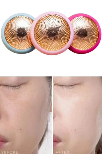 LitaeTrend Mini Saç Derisi Masaj Aleti Led Işık Terapisi Cildi Yatıştırır ve Dengeler - Resim 5