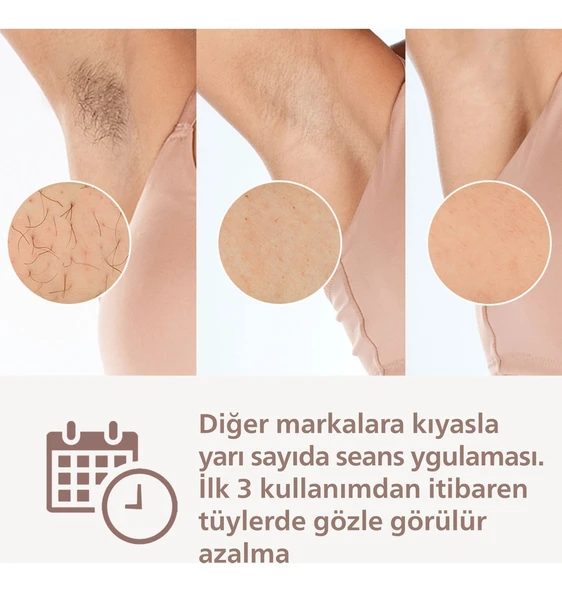 PHİLİPS BRI950/02 Lumea Lazer Epilasyon Ipl Tüy Alma Cihazı - Resim 3