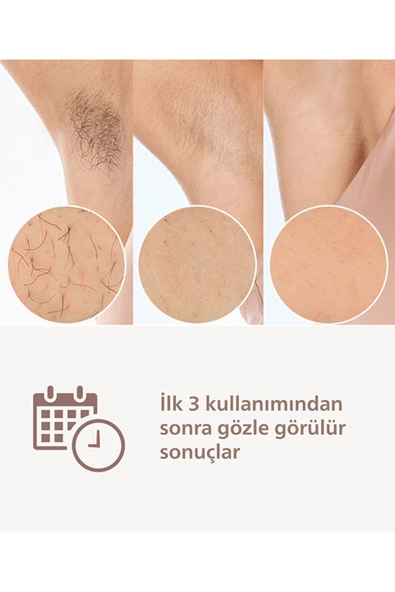 Lumea BRI953/01 Lazer Epilasyon IPL Tüy Alma Cihazı/3 akıllı aparat-Hassas Bölge,Yüz,Vücut - Resim 2