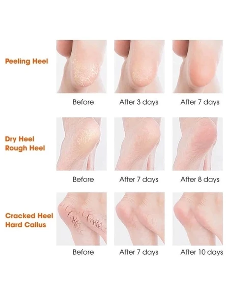 Silikon Topuk Nemlendirici Çorap - Resim 2