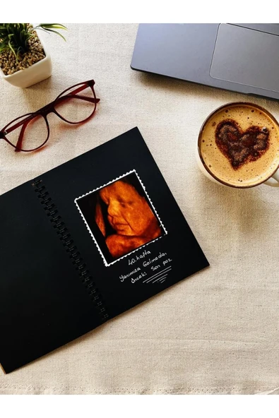 Kampus Kırtasiyem Siyah Yapraklı Defter Spiralli 14x20 90gr. 40 Sayfa Ve Beyaz Kaliteli Jel Kalem Hediyeli-t489 - Resim 4