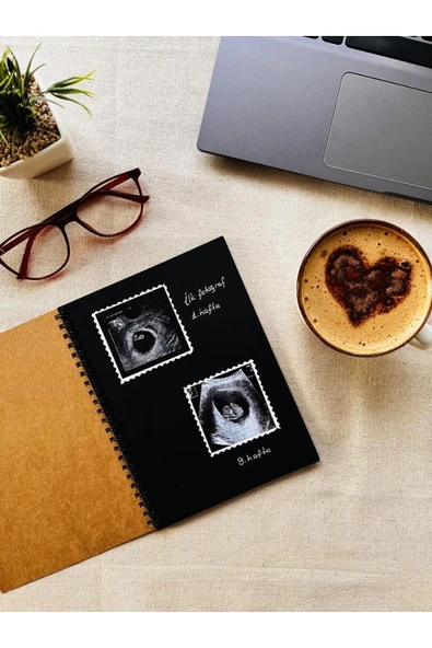 Kampus Kırtasiyem Siyah Yapraklı Defter Spiralli 14x20 90gr. 40 Sayfa Ve Beyaz Kaliteli Jel Kalem Hediyeli-t489 - Resim 2