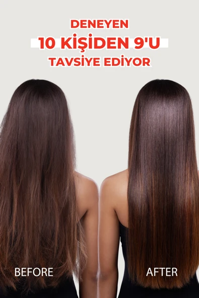 Zigavus Forte Ultra Şampuan Yağlı Saçlar İçin 300 ml - 3 Al 2 Öde Özel Fiyat Etiketli - Resim 7