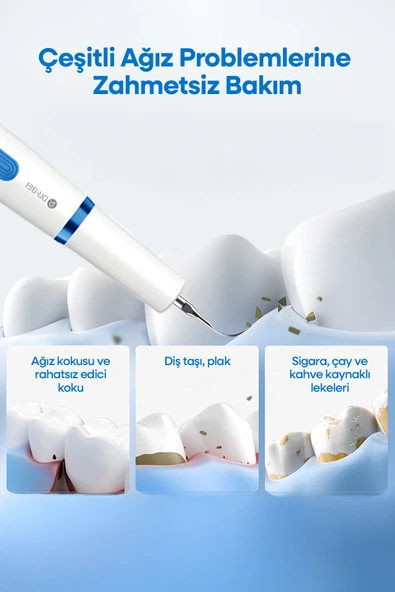 Gyc2 Şarjlı Diş Taşı Temizleme Cihazı - Resim 7