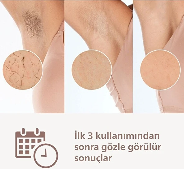 Philips Lumea Prestige Ipl Tüy Alma Cihazı + Vücut Ve Yüz Başlığı Brı950/00 Beyaz - Resim 3