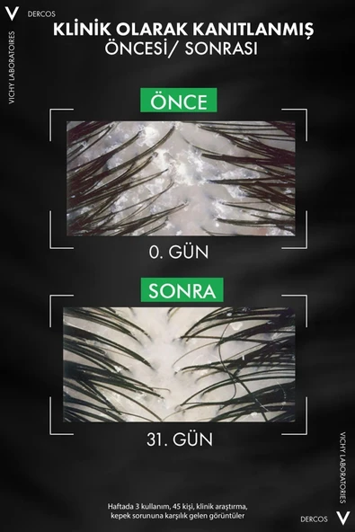 Vichy Dercos Anti Dandruff 2’si 1 Arada Tüm Saç Tipleri İçin Kepek Karşıtı ve Nemlendirici Şampuan 390 ml - Resim 11