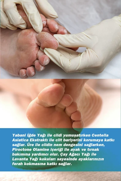 TTO Ayak Bakım Köpüğü 150 ml ürün görseli 1