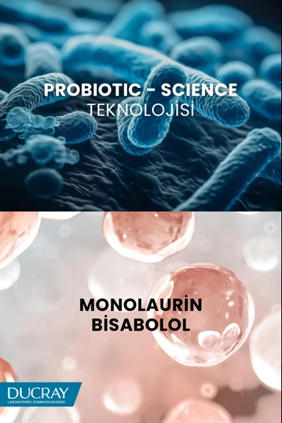 Ducray Kelual Squanorm Normal ve Yağlı Saçlar İçin Kepek Karşıtı Şampuan 400 ml - Resim 4