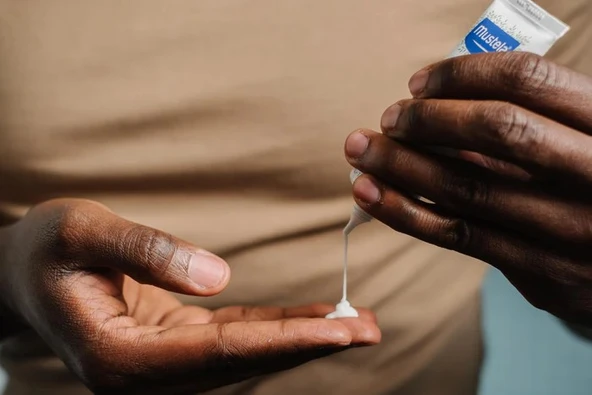 Mustela Cradle Cap Cream 40 Ml - Resim 2